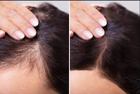 Doctor examining patient's hair for treatment